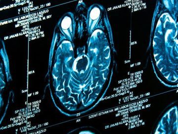 Tigers hybrid cloud storage targets medical imaging scaled