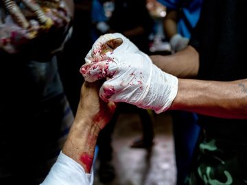 They Supported Air Strike Victims Then They Were Doxed and