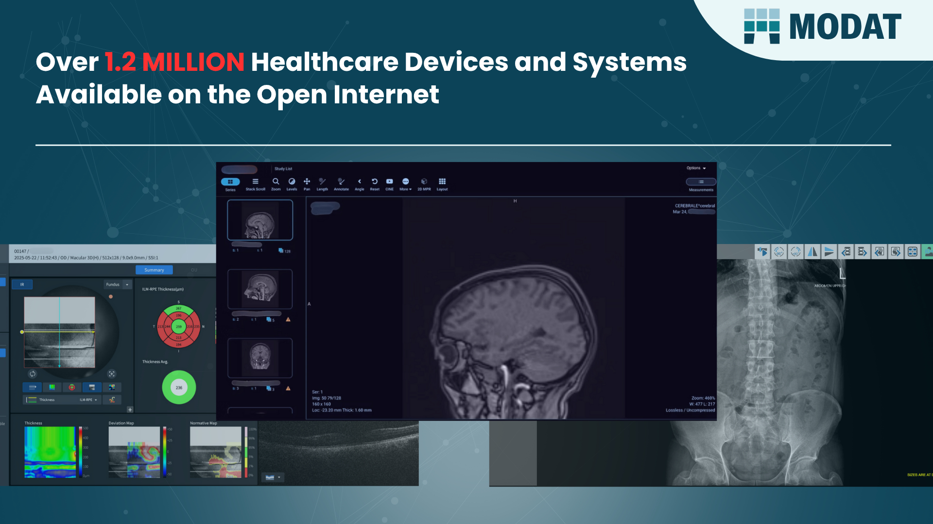 1.2M Healthcare Devices and Systems Found Exposed Online 1.2M Healthcare Devices and Systems Found Exposed Online - Patient Records at Risk of Exposure, Modat